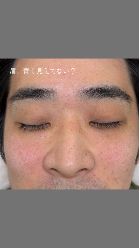 copy BA31DF54 F741 46F2 AE40 55925BAEBBF1 576x1024 - 眉、青く見えてない？？ / メンズ眉