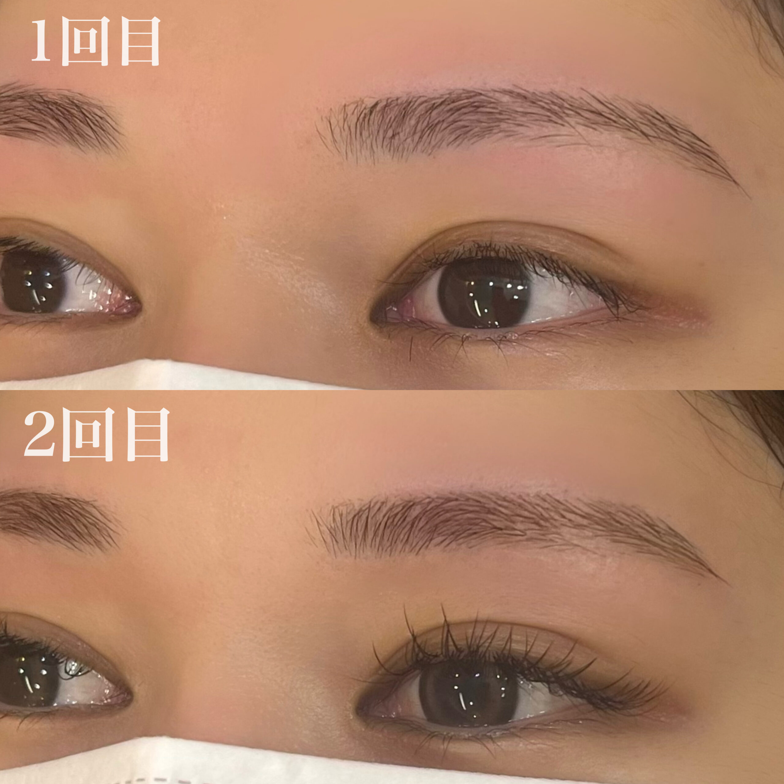 眉が生えない方へ|回数を重ねるとここまで整います phonto scaled - 眉が生えない方へ|回数を重ねるとここまで整います
