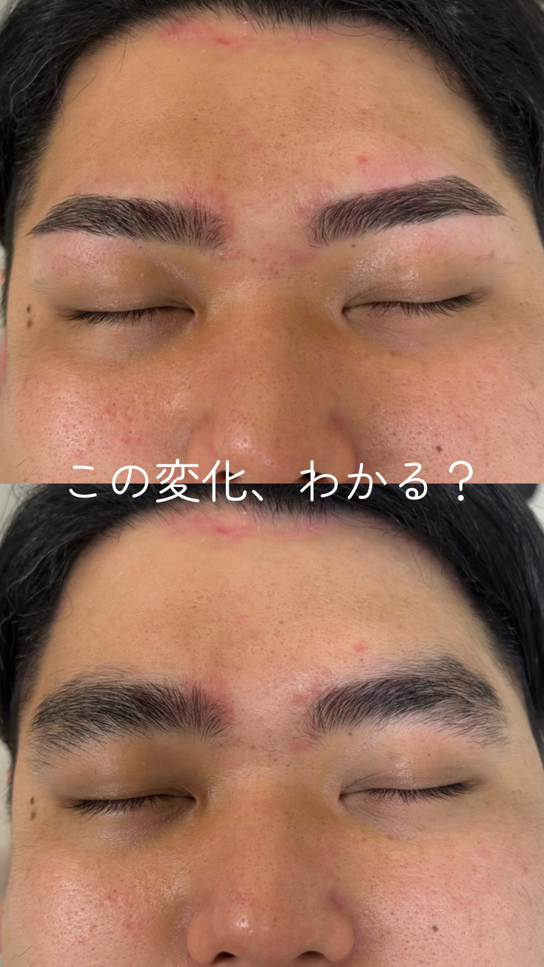 copy 08D9F542 B135 45C3 9740 612F5AFD54E2 - この変化、わかる？