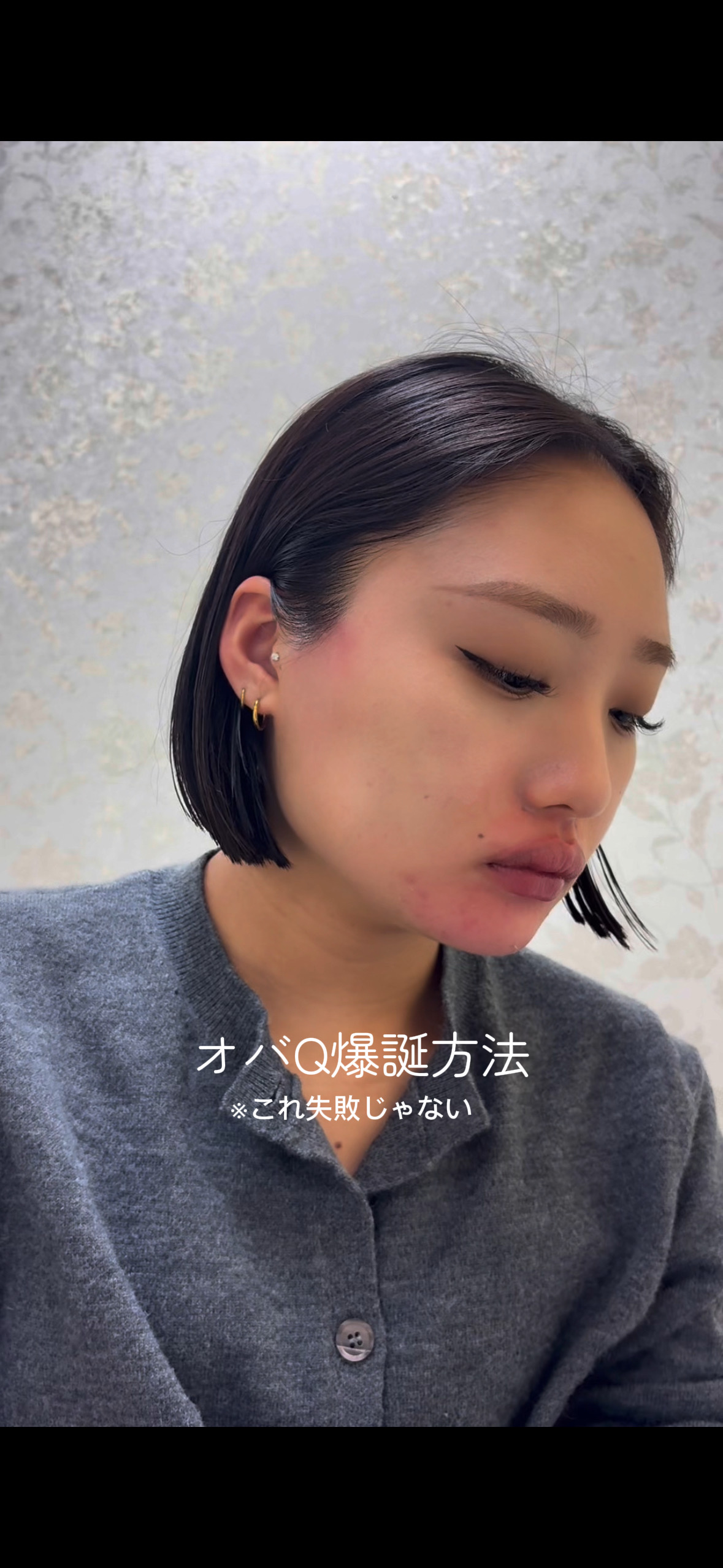 口周りワックスでオバQ爆誕?!?!?!? copy A11B8CE8 9F2F 4086 9504 30A95696035D - 口周りワックスでオバQ爆誕?!?!?!?