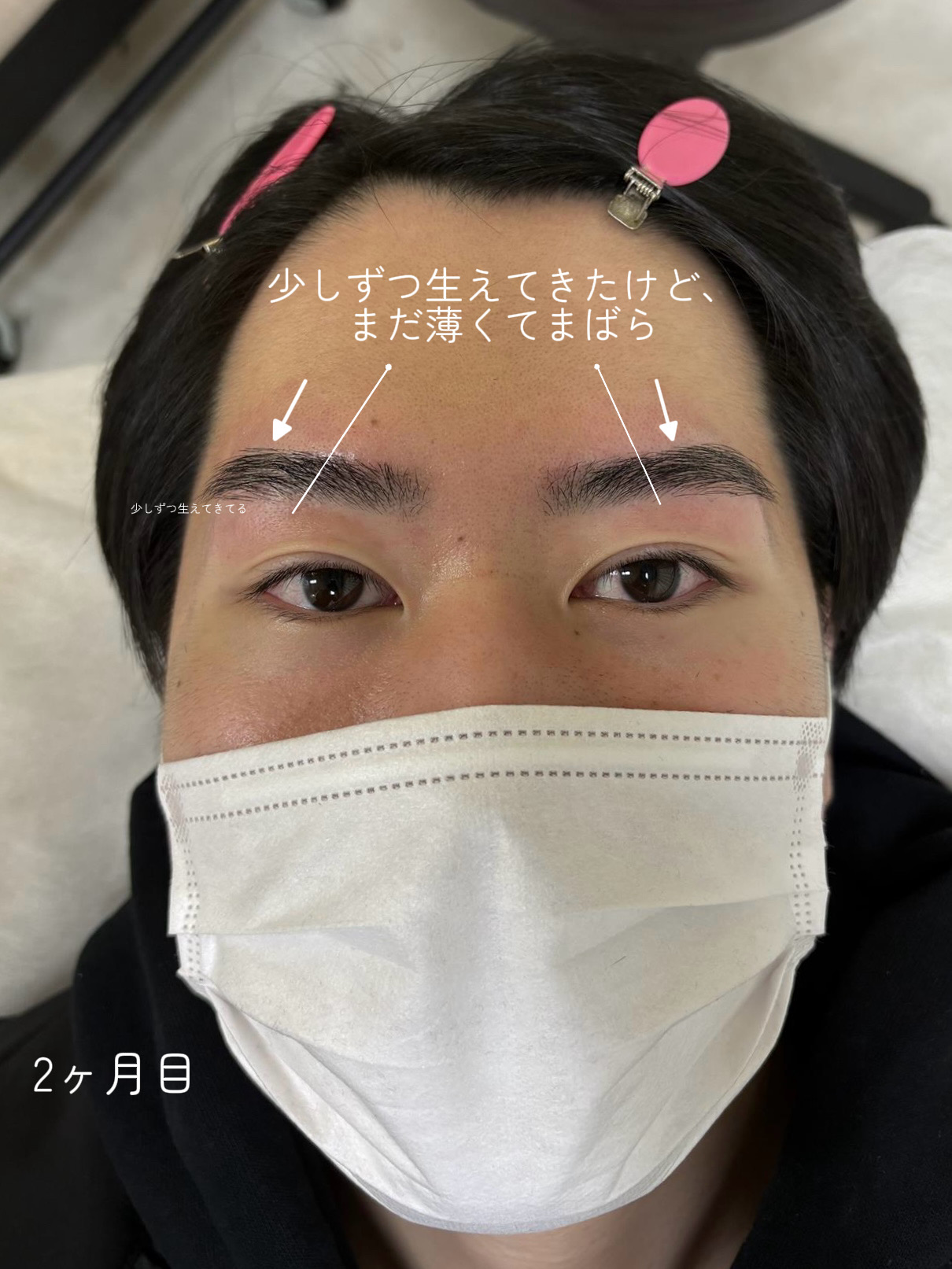 copy 5F2A594D 296C 42DB 888D 11589467B731 - 安易に細くしてはダメです&times;