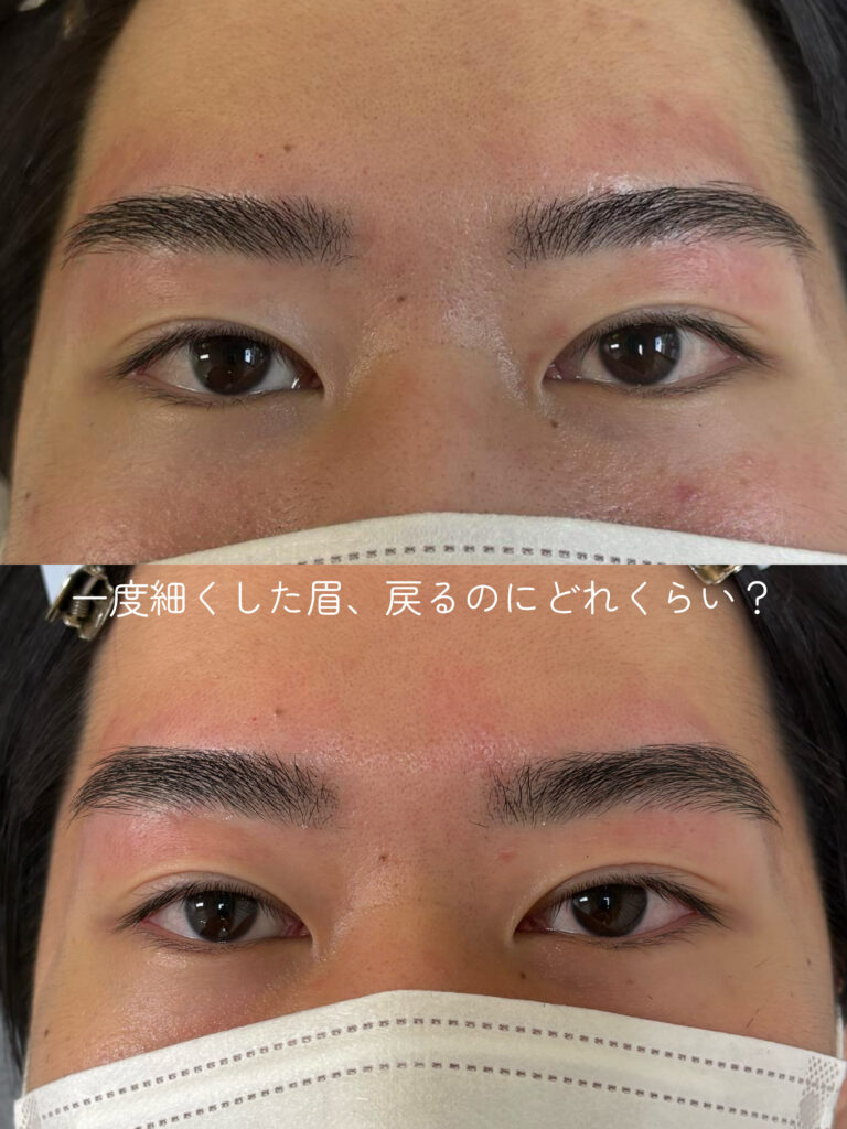 copy 78BE03EE 3862 4931 9DD4 B27E359D213B 768x1024 - 安易に細くしてはダメです×