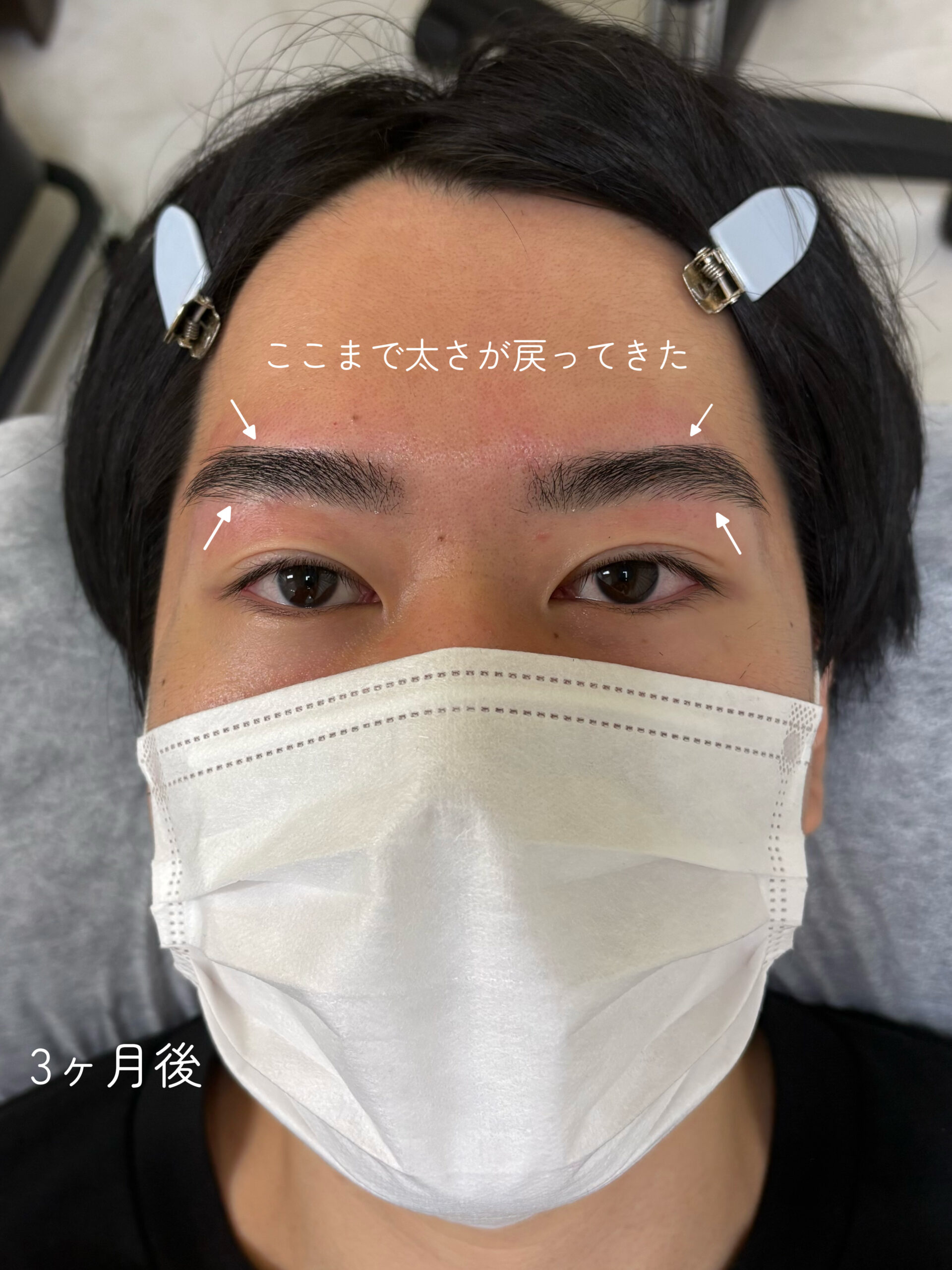 copy F9CB7770 AC33 4AD6 8444 042A5ADDE20C scaled - 安易に細くしてはダメです&times;